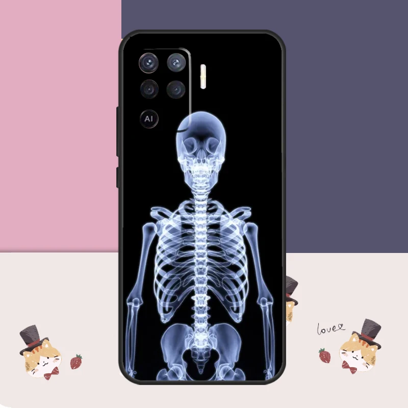 Radiological Human Organs Skeleton For OPPO A77 A57 A18 A58 A78 A98 A15 A17 A54 A74 A94 A52 A72 A5 A9 A53 S A16 A76 A96 Case