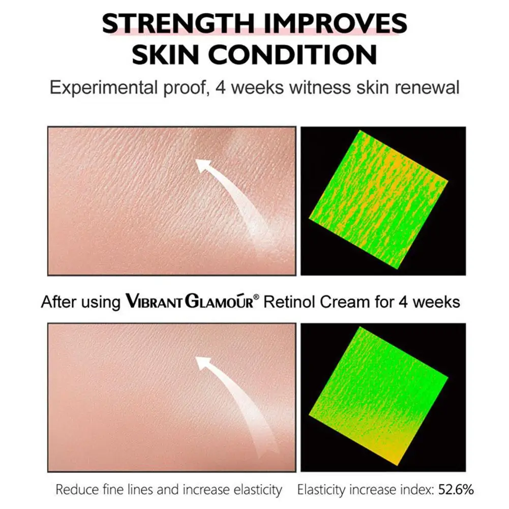 كريم علاج الوجه بالريتينول ، التجاعيد ، الترطيب ، الثبات ، الخطوط الخفيفة ، مكافحة الشيخوخة ، إزالة البقع ، النمش ، تفتيح ، بشرة