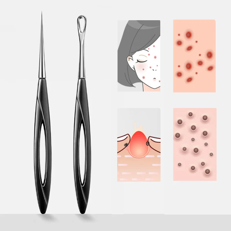 Acne agulha clipe removedor de cravo extração acne beleza poros cabeça preta limpador rosto cuidados com a pele limpeza profunda agulha ferramenta