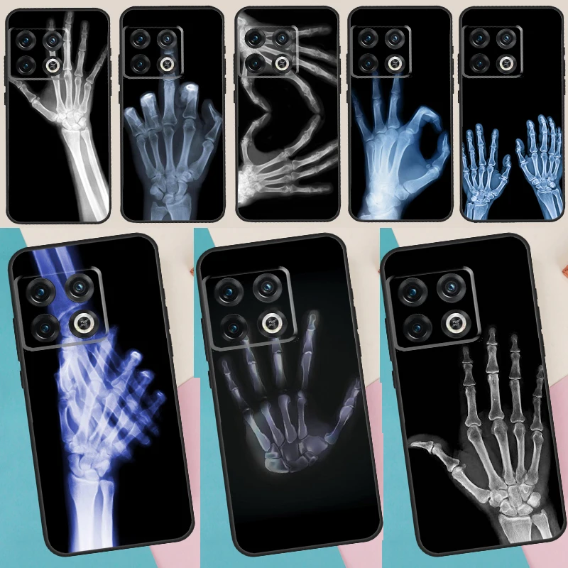 X-ray Hand Bones Phone Case For Oneplus Nord 2 T Ace 10R 9 R One Plus 10 9 Pro Soft Silicone Back Cover Funda