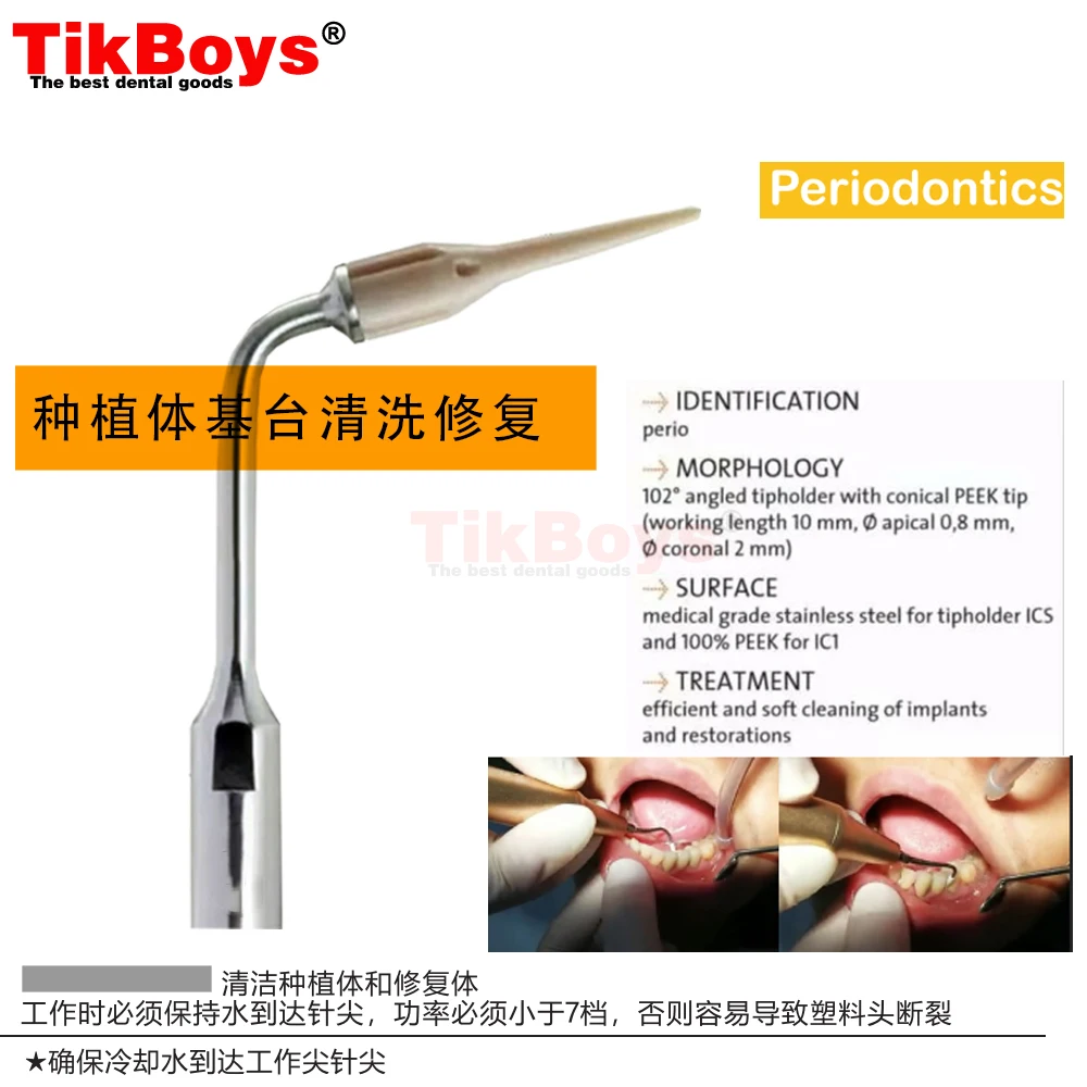 Dental Scaler Tip Periodontal Implant Cleaning P90 PD90 P94 P95 P96R P96L ICP Fit EMS Woodpecker Satelec DTE NSK Ultrasonic Tool