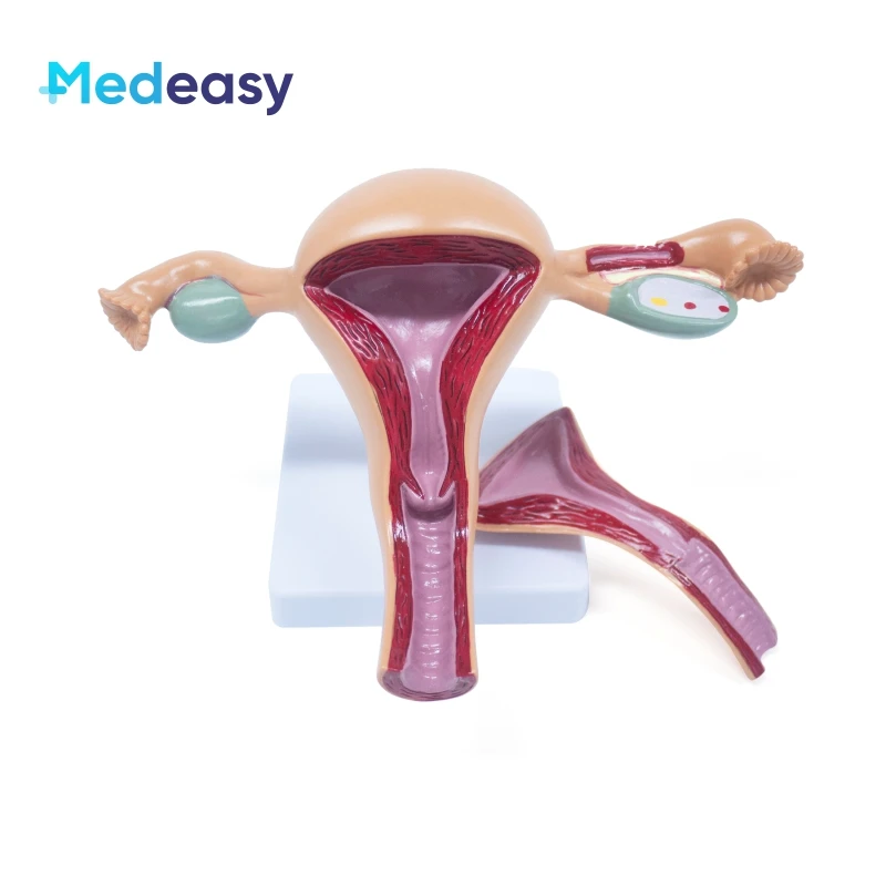 Female Uterus and Ovary Anatomical Model Vagina Model Plastic Uterus Model Normal/Diseased Uterus Model