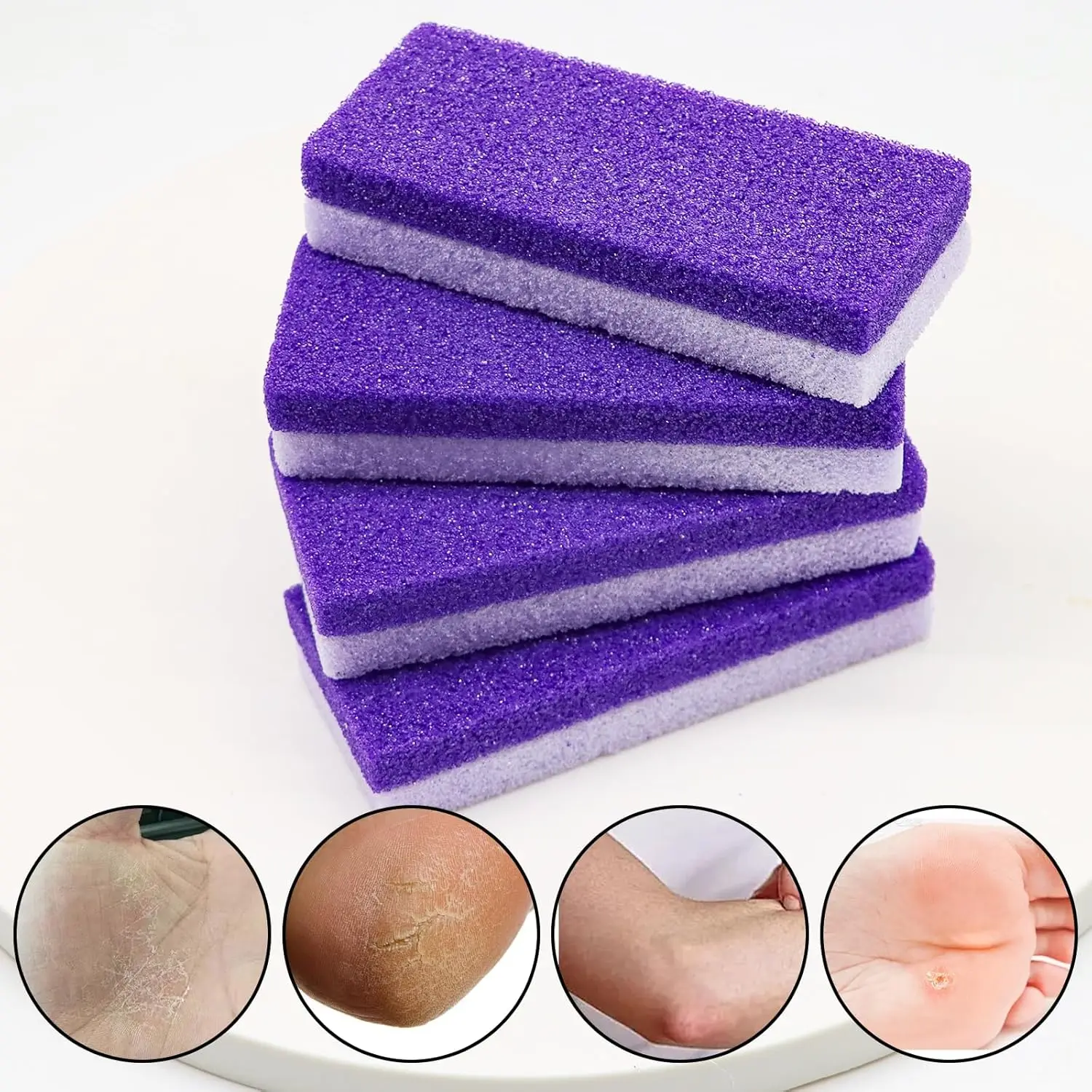 2/4 Stuks Voet Puimsteen Voet Bestand Eelt Dode Huid Remover Voet Hak Scrubber Gladde Voeten In seconden Pedicure Peeling Tool