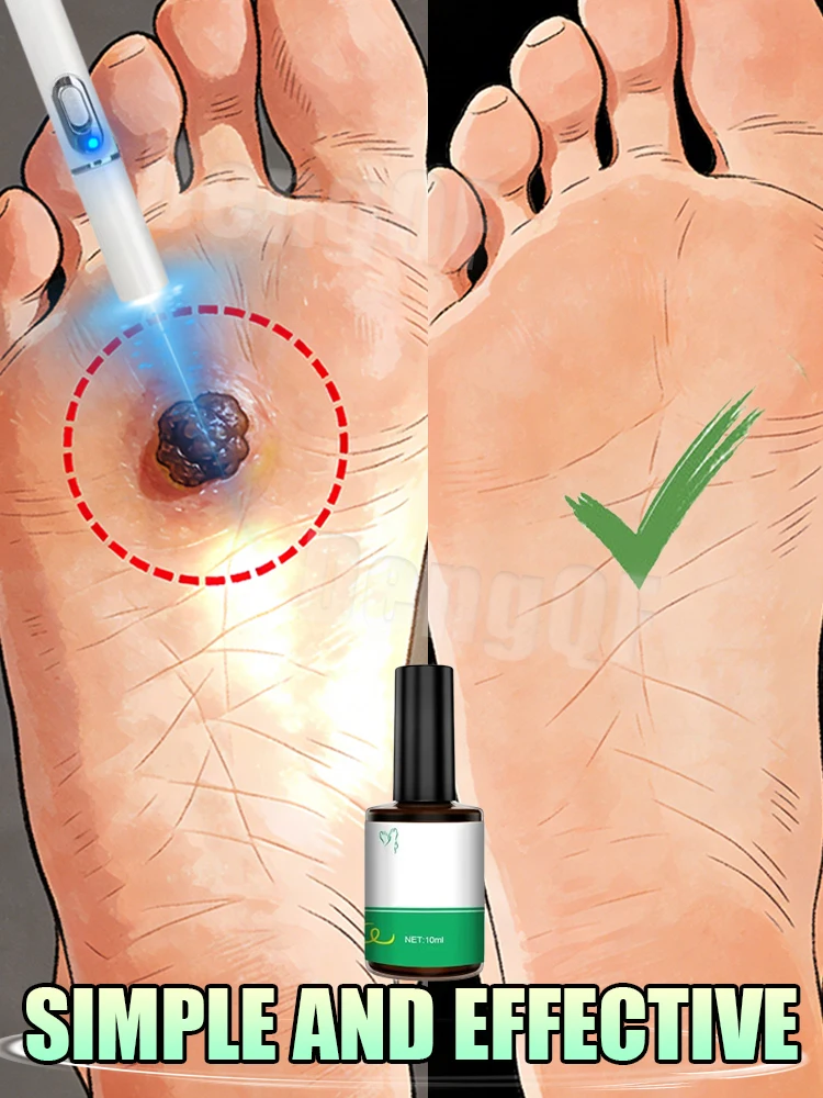 

The latest style of laser pen takes care of your foot health