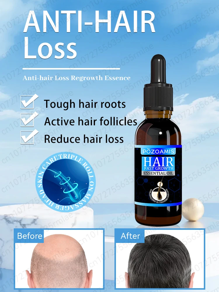 Hair growth oil rapid hair growth effectively repairs baldness hereditary hair loss postpartum hair loss seborrheic alopecia