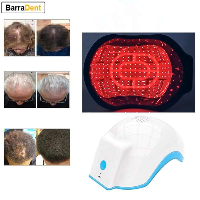 

272 Diodes 678nm Wavelength Laser Hair Growth Helmet USB Rechargeable Hair Therapy For Hair Regrowth and Hair Loss Treatment