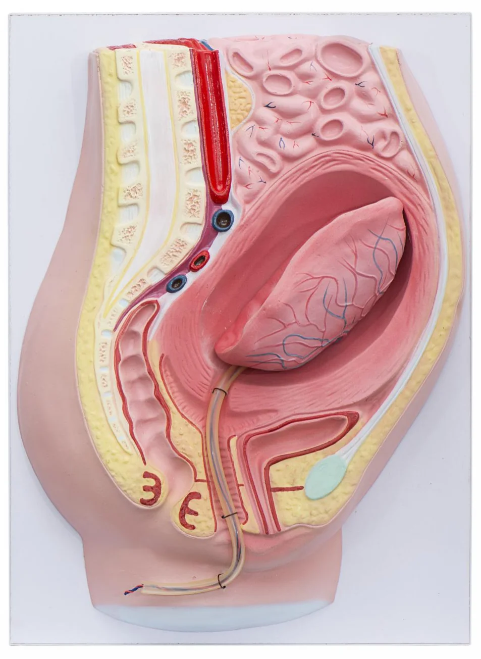 

Placental Detachment Model Placental Separation Simulator Advanced Human Anatomy Medical Training Module