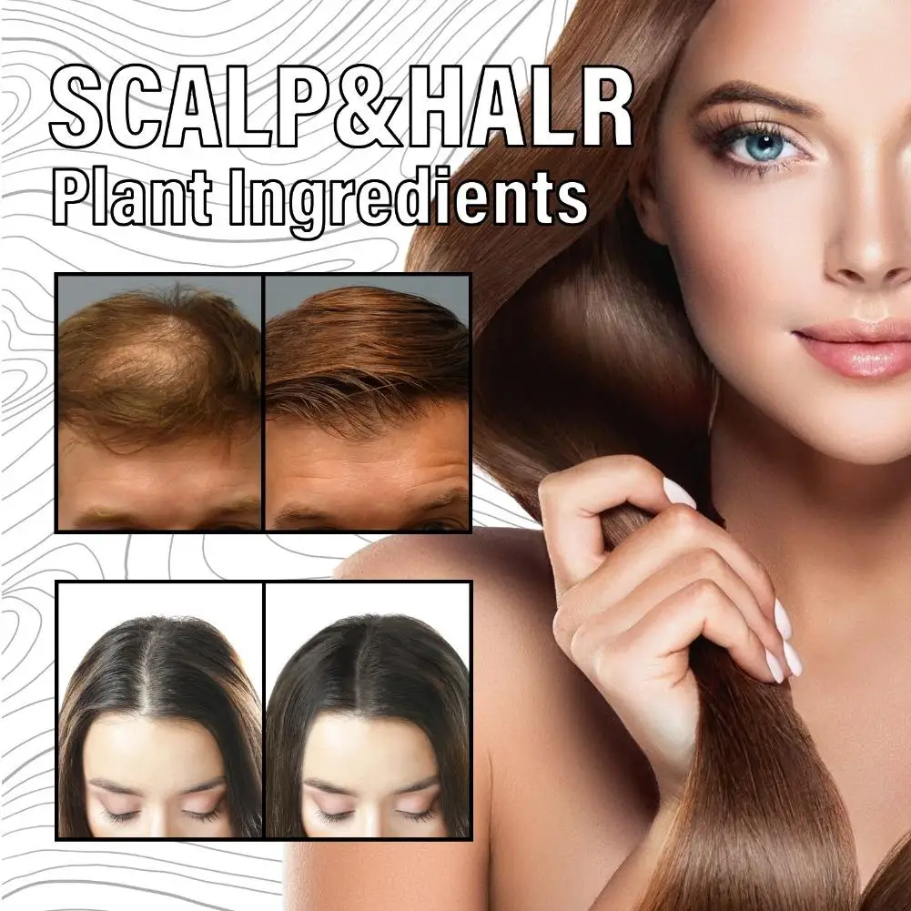 Hair Care Serum Anti-Hair Loss Essence Scalp Nourishing Formula Promotes Hair Growth for Thicker Dense Healthy Looking Hair