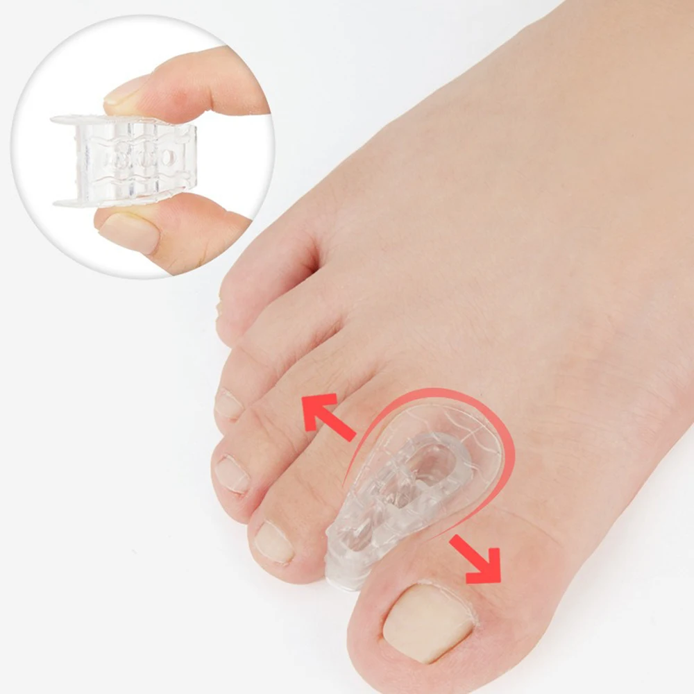 Toe Orthosis Clip Pads Big Foot Bone Care Tools Splitter Thumb Hallux Valgus Bunion Corrector Overlap Separators Foot Care Tools