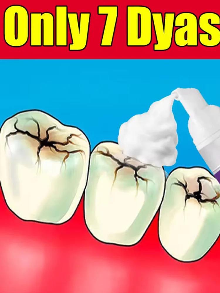 Tooth decay Repair Repairing Cavities Protecting Anti Caries