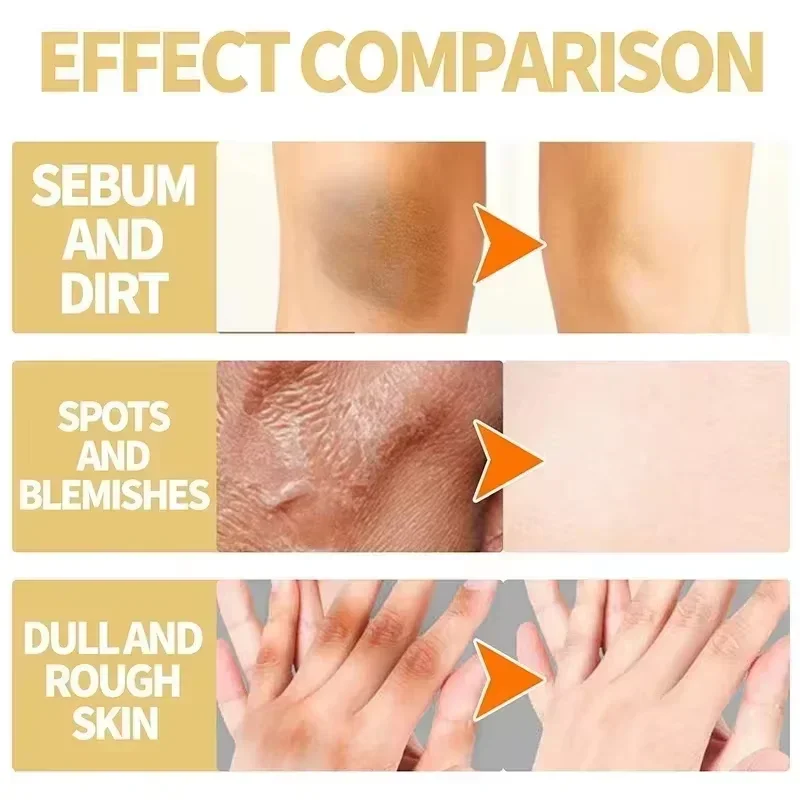 Yellow Peeling Oil Exfoliating Dead Skin Serum Care Dark Skin Bleaching Remove Knee Arm Leg Melanin Body Whiten Brighten Scrub