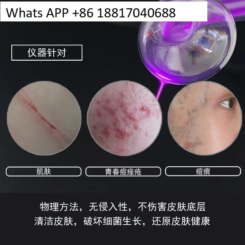 Schönheitsinstrument Regenbogenentladung Ozonsterilisation Akne Akne Schönheit D-217