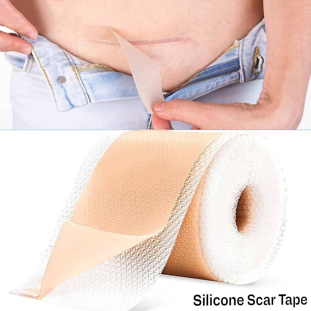 

1Roll Silicone Scar Sheets - Silicone Scar Tape,Scars Silicone Strips, Reusable, Professional Scars Removal Sheets for C-Section