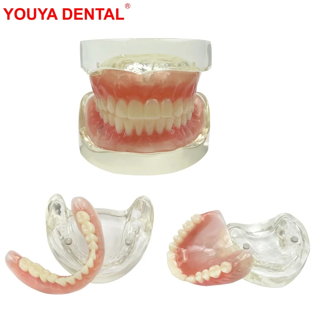 

Dental 2 Implants Model For Education Studying Teaching Dentistry Maxillary/Mandibular Overdenture Upper/Lower Jaw Teeth Models