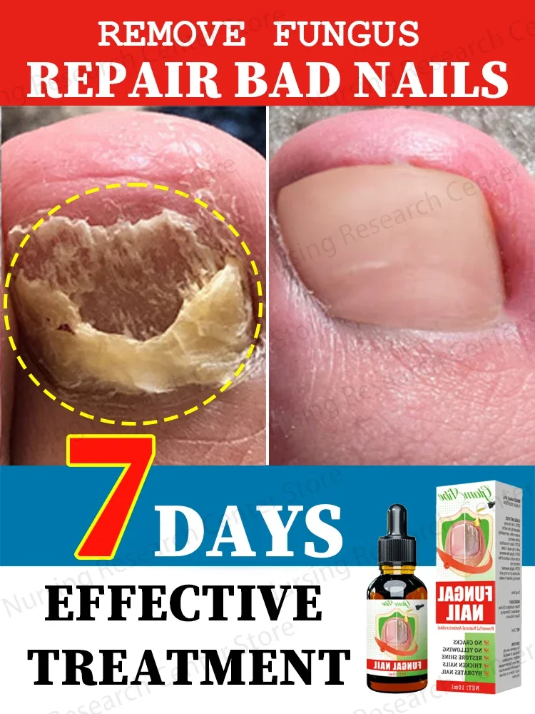 Foot nail problems disappear