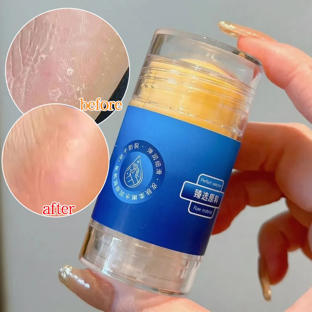 فازلين مكافحة تكسير ترطيب كريم حماية اليد القدم الكراك أداة واقية الشتاء ترطيب عصا كريم القدم الرعاية #1