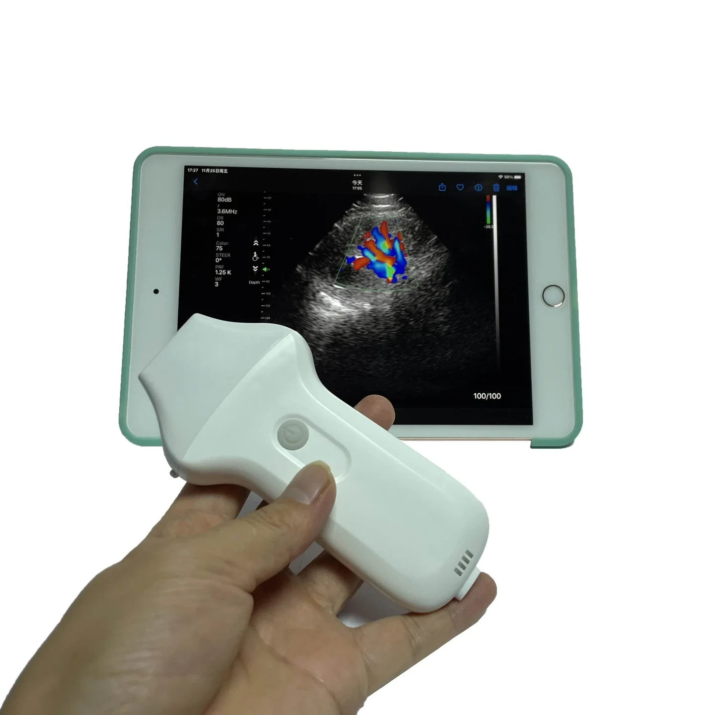 

wireless phased array ultrasound probe echocardiography cardiac transducer scanner price