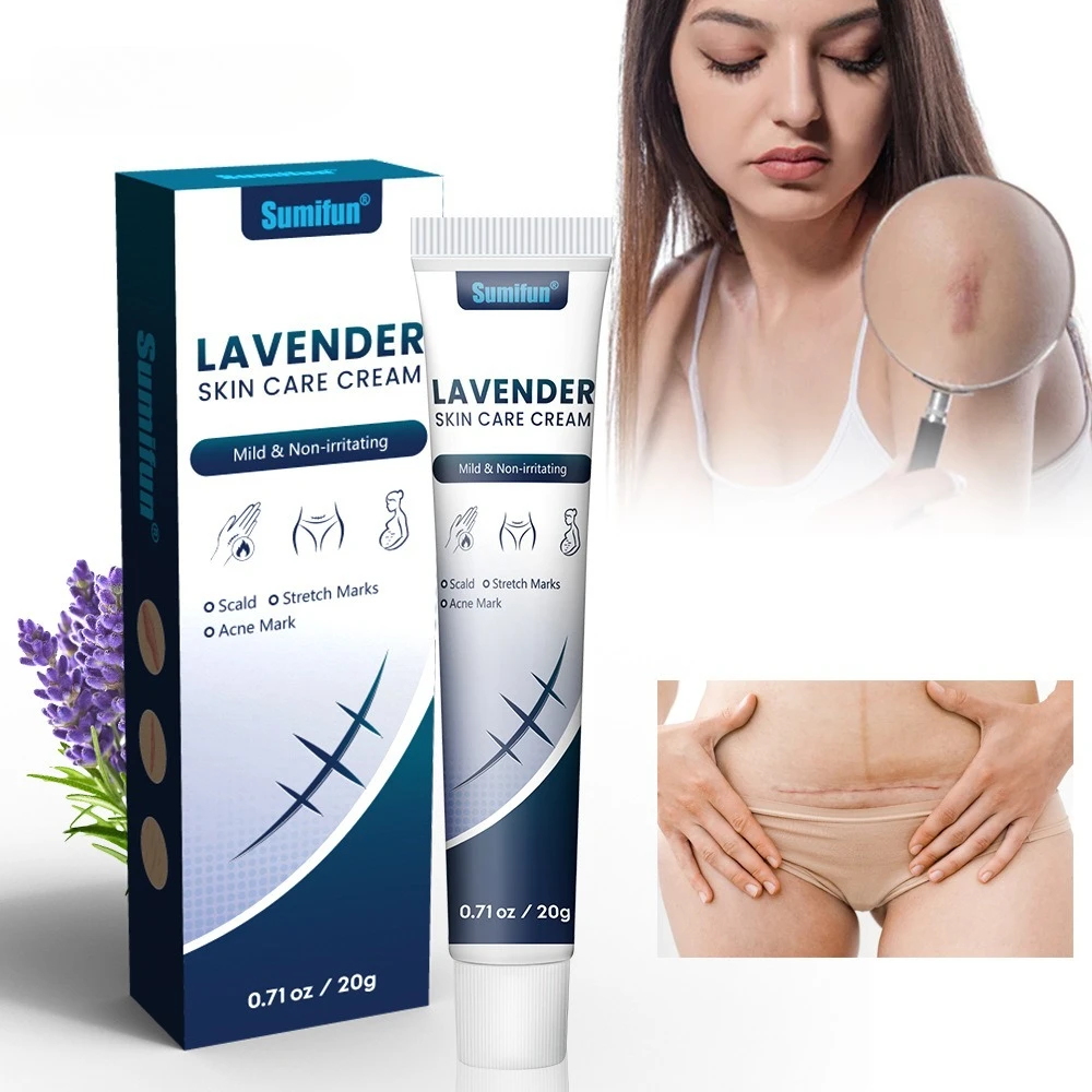 라벤더 오일이 함유된 천연 흉터 제거 젤, 오래된 흉터, 튼살, 수술 후 흉터, 여드름 자국 개선