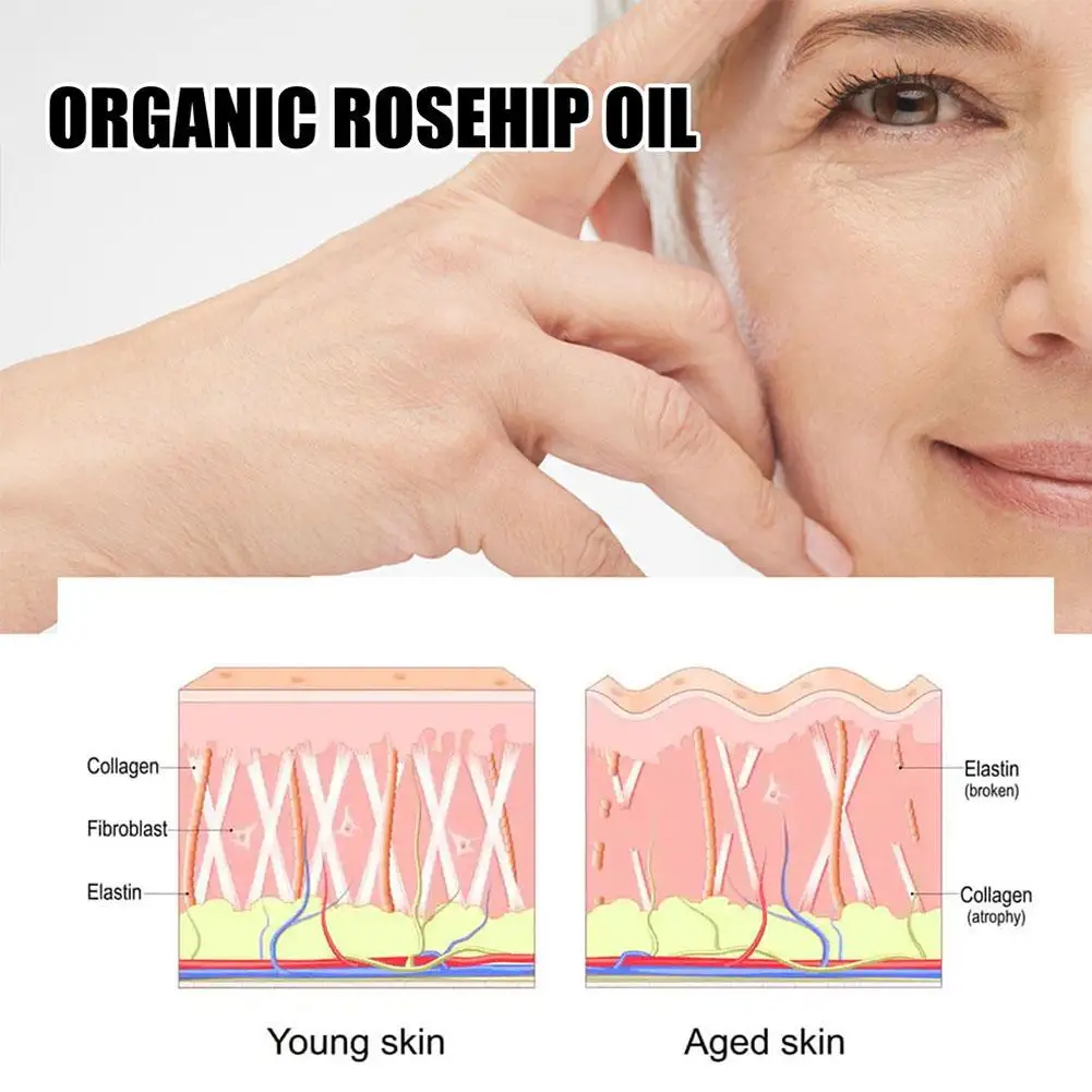 30ml Organic Rosehip Seed Oil For Face Pure Cold Pressed Facial Oil Natural Moisturizing Skin Care Serum Q4A8