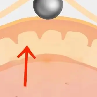 

100 шт., нашивка из бисера для ушей, аурикулотерапия, дышащая точечный массаж, пресс для ушей, нашивка из бисера, наклейка, пластырь из бисера для акупрессуры