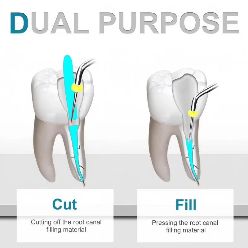 1pcs Dental Teether Pen Heating Tip Hot Melt Pen Accessory Root Canal Tip Dentist Hot Melt Filling Heating Needle Dentist Tool