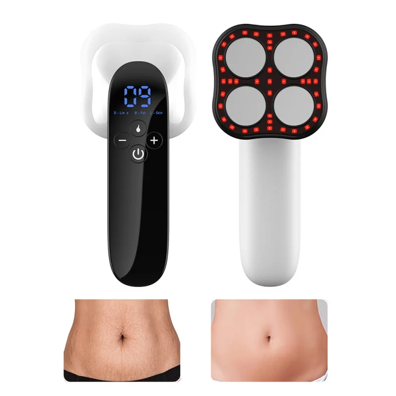 Máquina de masaje de celulitis para mujeres, piernas, vientre, cuerpo, quema grasa