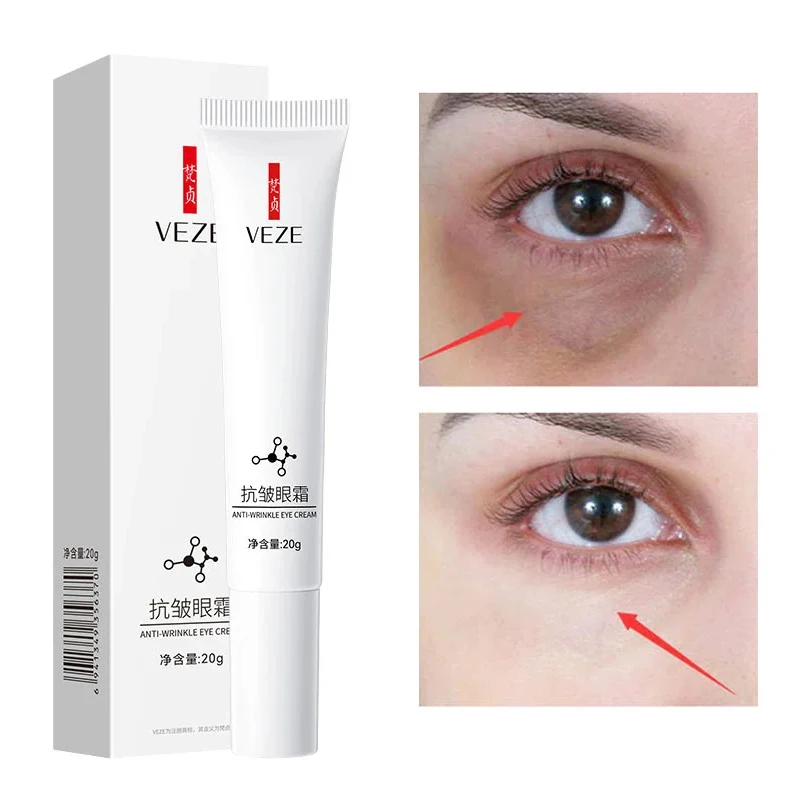 Crème pour les yeux à la nicotinamide, sérum optimiste, élimine les cernes et les poches sous les yeux, contre les poches, acide hyaluronique, gel de soin des yeux