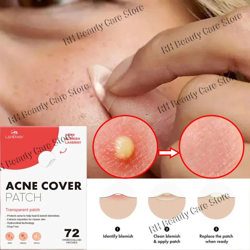 Пластыри от прыщей, невидимое покрытие от прыщей, контроль жирности для лица, впитывающая прыщи, жидкость, прозрачный очищающий пластырь от прыщей