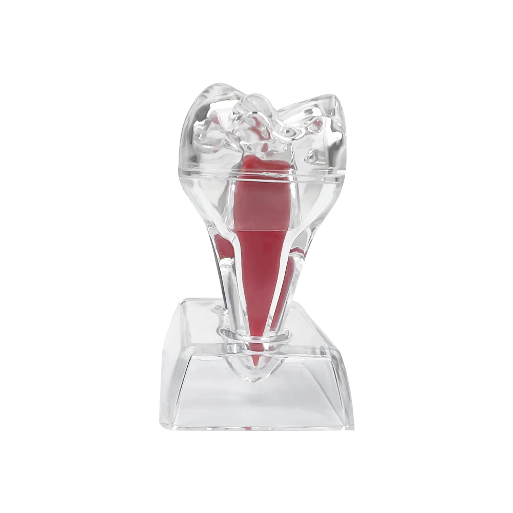 Teeth Model Dental Anatomical Structure Detachable Dental Anatomical Model Transparent Tooth Disintegration Model Dental Anatomy