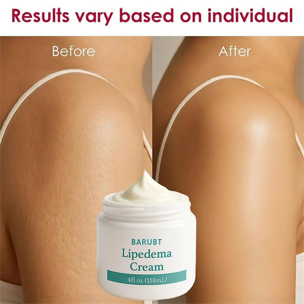 

Lipedema Treatment Cream, Smooth Skin Anti-Cellulite Cream, Body Contouring for Women Men, for All Skin Types