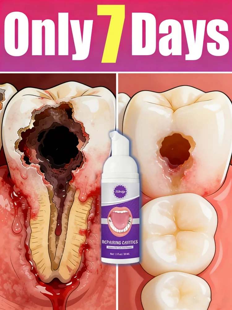 

2026 2nd generation ᴘʀᴏᴍᴏᴛᴇs ᴇᴀsʏ ʀᴇᴘᴀɪʀ ᴏᴒ ᴄᴀᴠɪᴛɪᴇs ɪɴ 7 ᴅᴀʏs