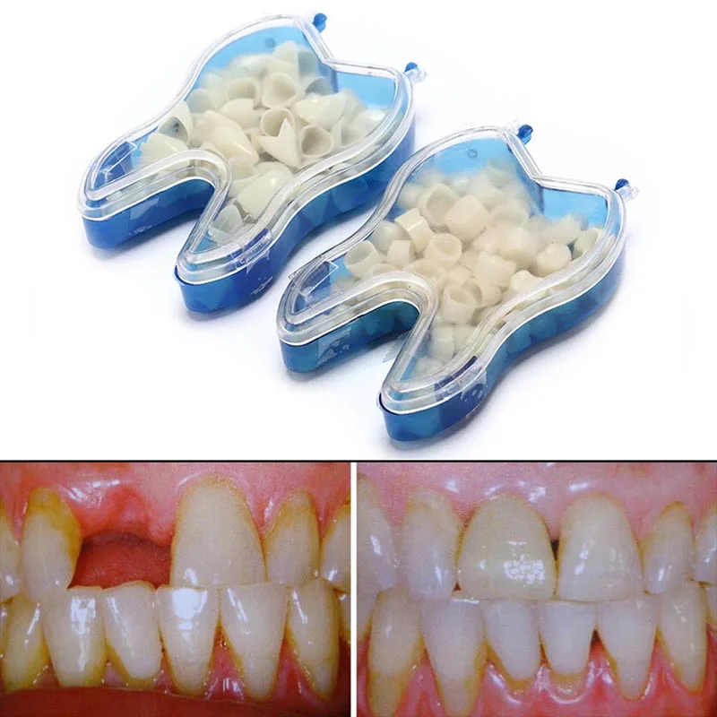 50Pcs/Box Dental Temporary Crown Kit Anterior Front Molar Posterior Teeth Veneers Oral Care Tooth Whitening Dentist Material