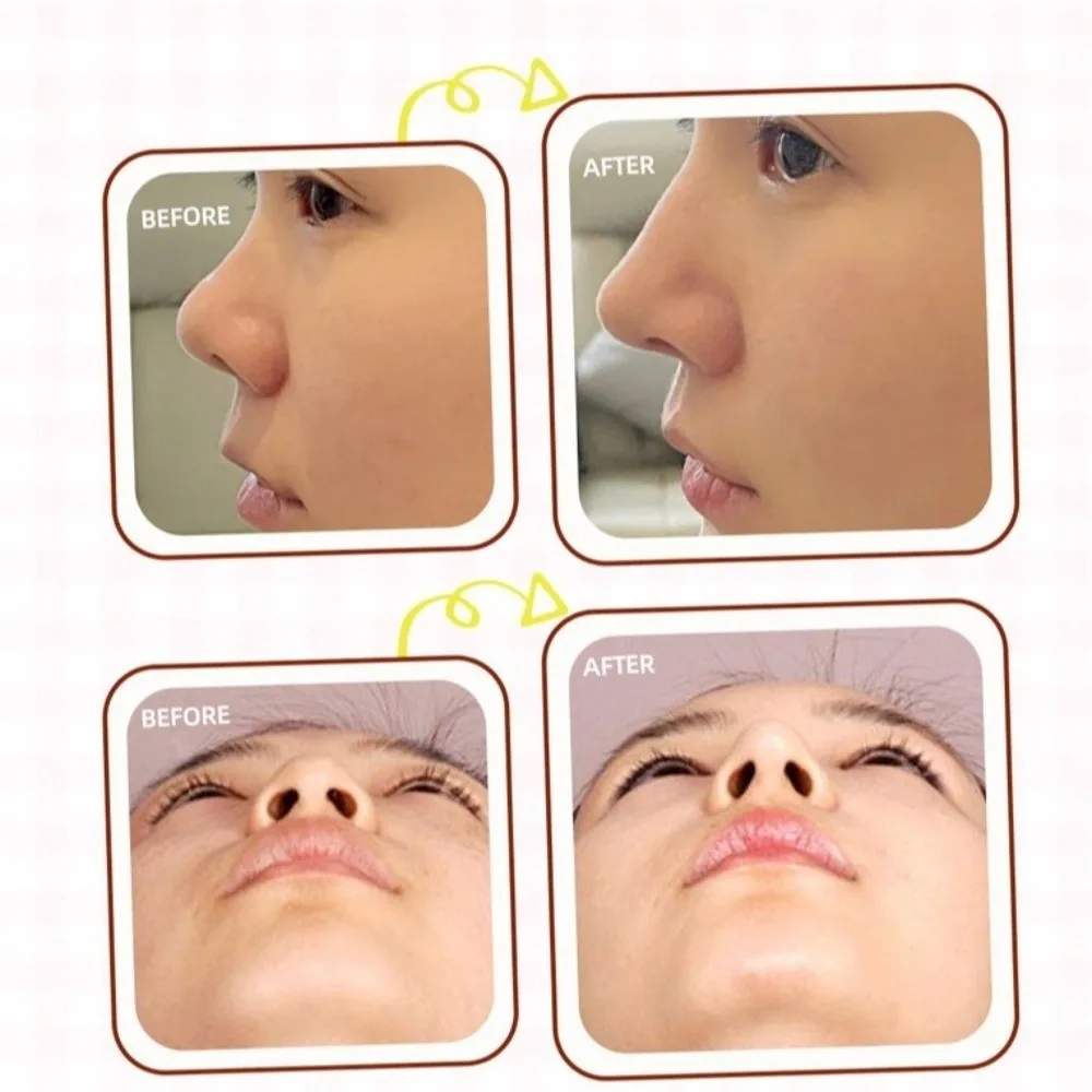 10/20/30/50Pcs Reusable Nose Shaping Stickers Adjustable Cute Design Nose Reshaping Tape Cuttable Elongated Exquisite Result