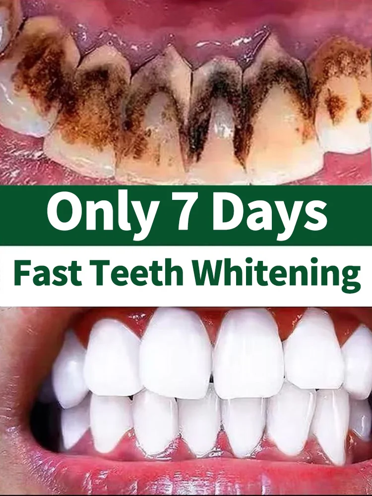 

Tartar removers dissolve tartar and remove stains fast whitening