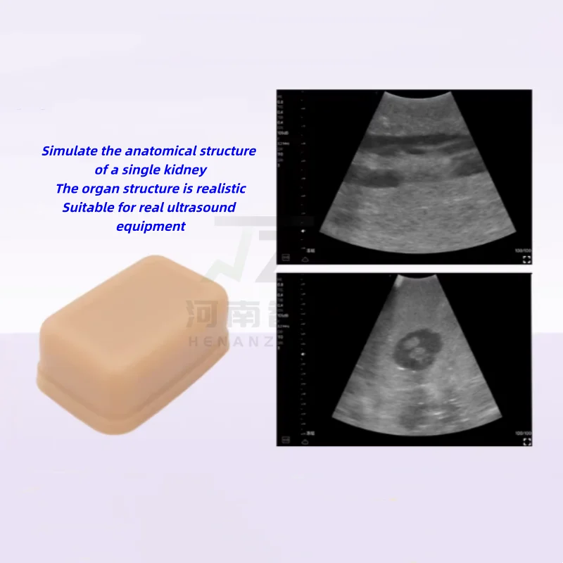Ultrasound-guided renal puncture model, percutaneous renal intervention B-ultrasound exploration practice lesion model