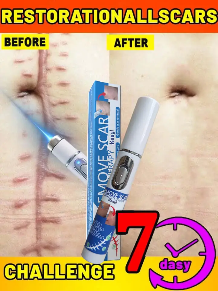 Recovery Scar Fast Remove Deep Skin Scar Acne Stretch Marks Burn Keloid Spot Treat scar laser Smooth Whiten Face Skin Care