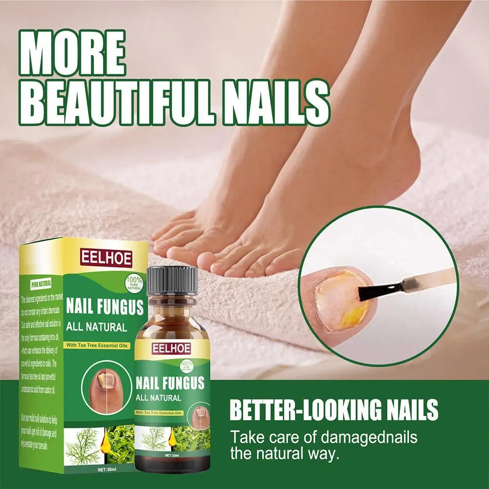 Nail Fungal Treatment Care Essence Nail Foot Whitening Removal Paronychia Anti Infection Gel Fungus Nails Onychomycosis K3M7