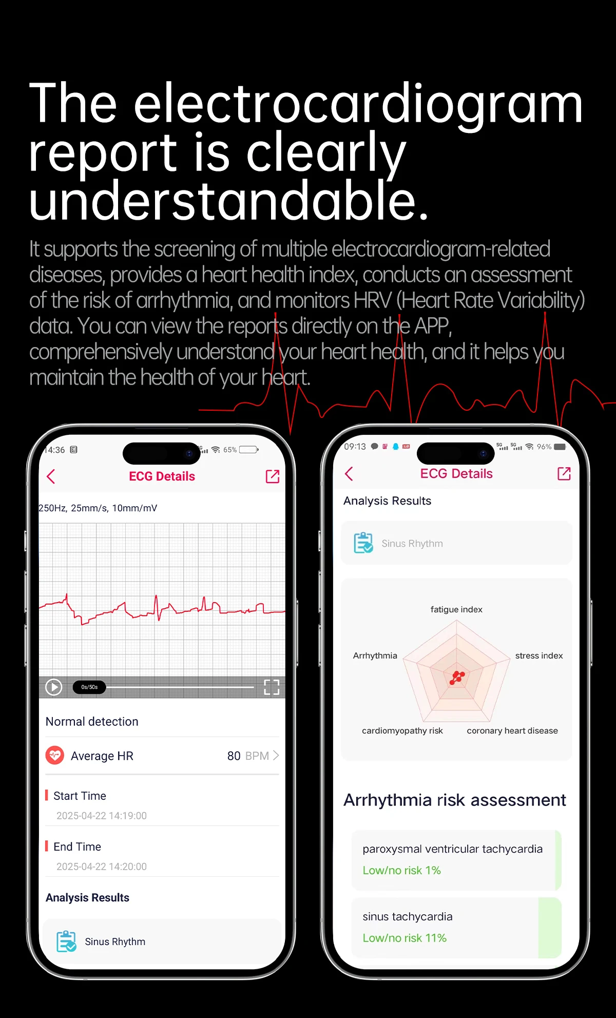 Marsyu Herren EKG+PPG Fünf-Organen-Gesundheitsdiagnose Smartwatch Harnsäure Blutfette Blutdruck Temperatur Herzfrequenz Smartwatches – Detail 6