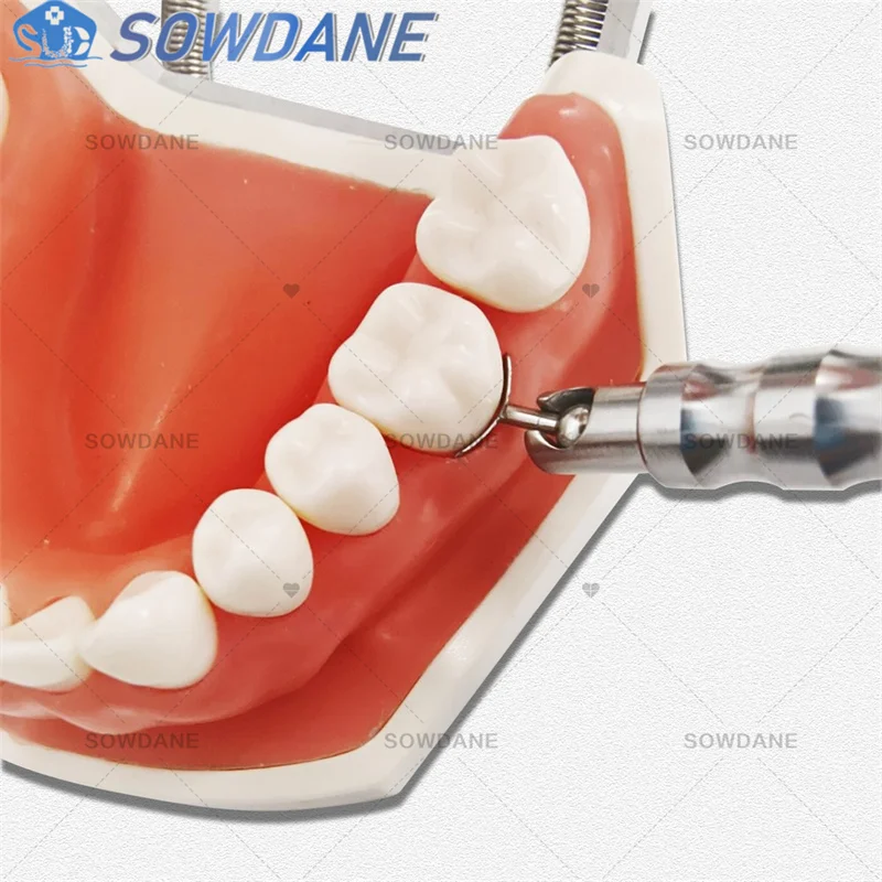 Adjustable Dental Implant Gingival Protecting Socket Shield Retractor Protector Gum Separator Isolation Tool Replaced tips