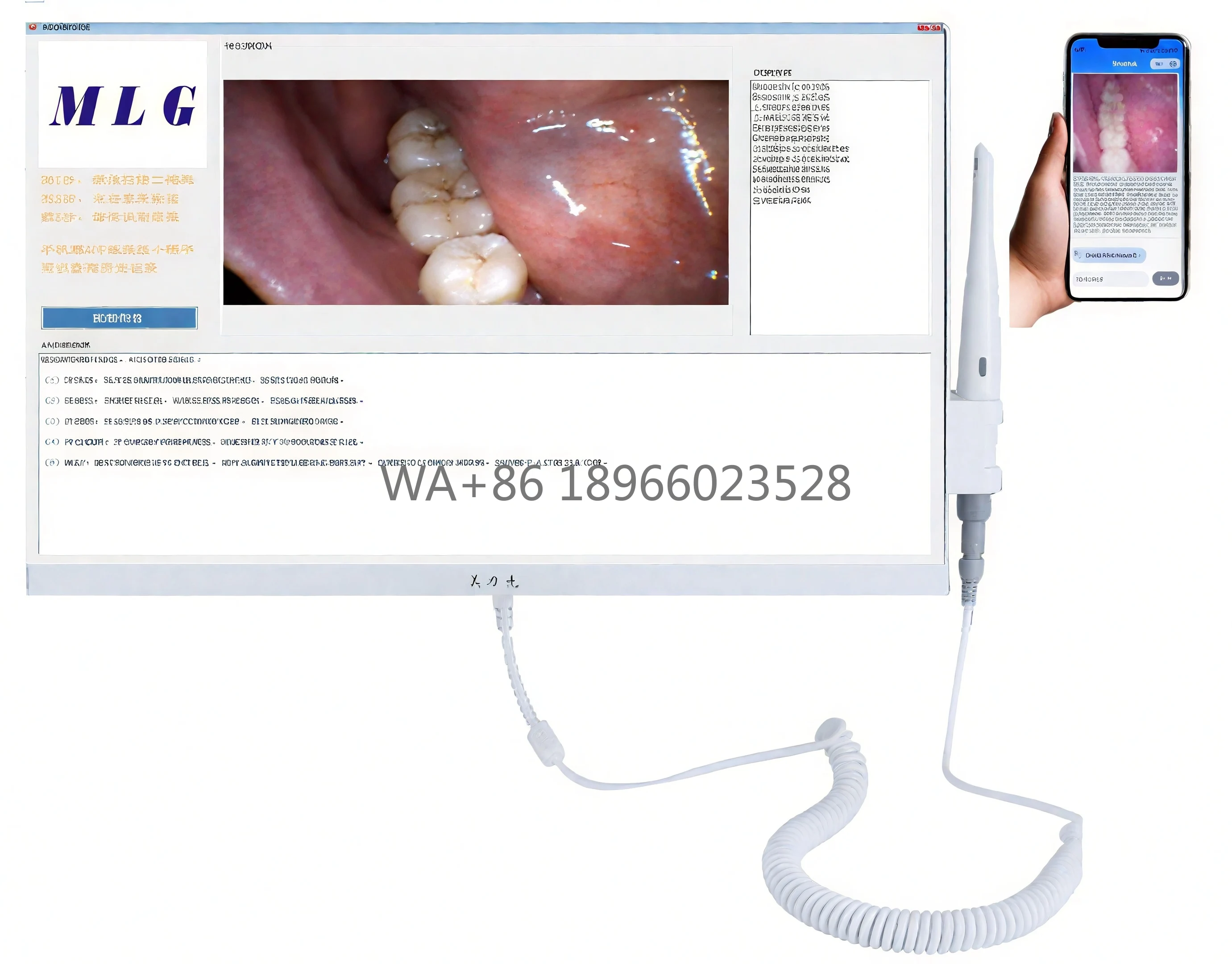 17 Inches Dental Medical LED Dental Endoscope Dental Endoscope Intraoral Scanner