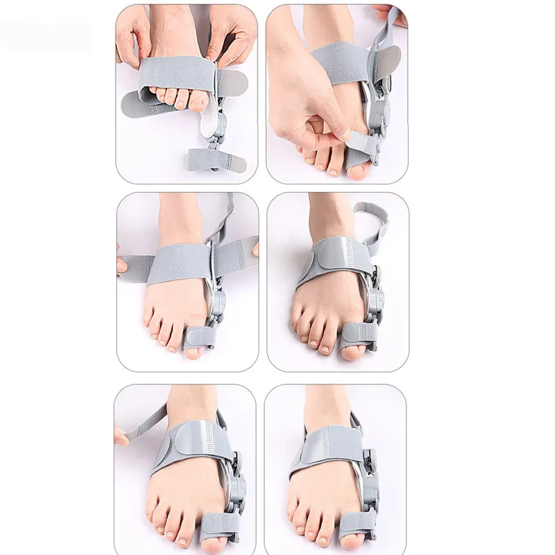 Adjustable Toe Corrector Unisex Bunion Foot Hallux Valgus Braces Rotatable Toe Separator Straightener for Left and Right Foot