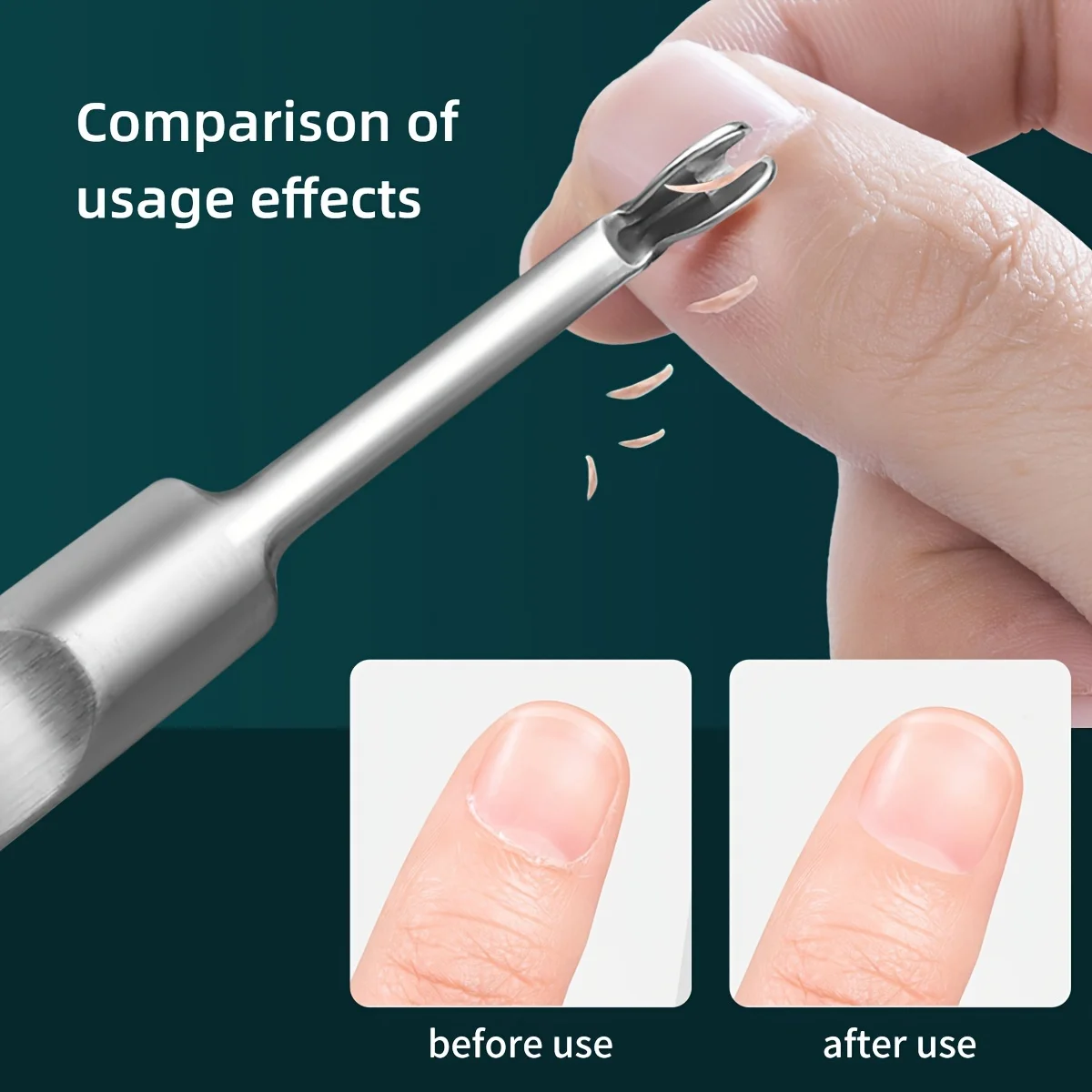 Nagellackentferner-Set aus Edelstahl – Gelschäler, Schaber und Reinigungsset für Hände, Füße – geruchlose Maniküre- und Pediküre-Pflege