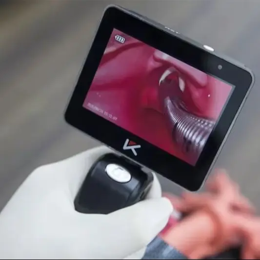 Portable Mcgrath Video Intubation Laryngoscope with Camera: A Replacement for McCoy, Ideal for Anesthesia Tracheal Replacement