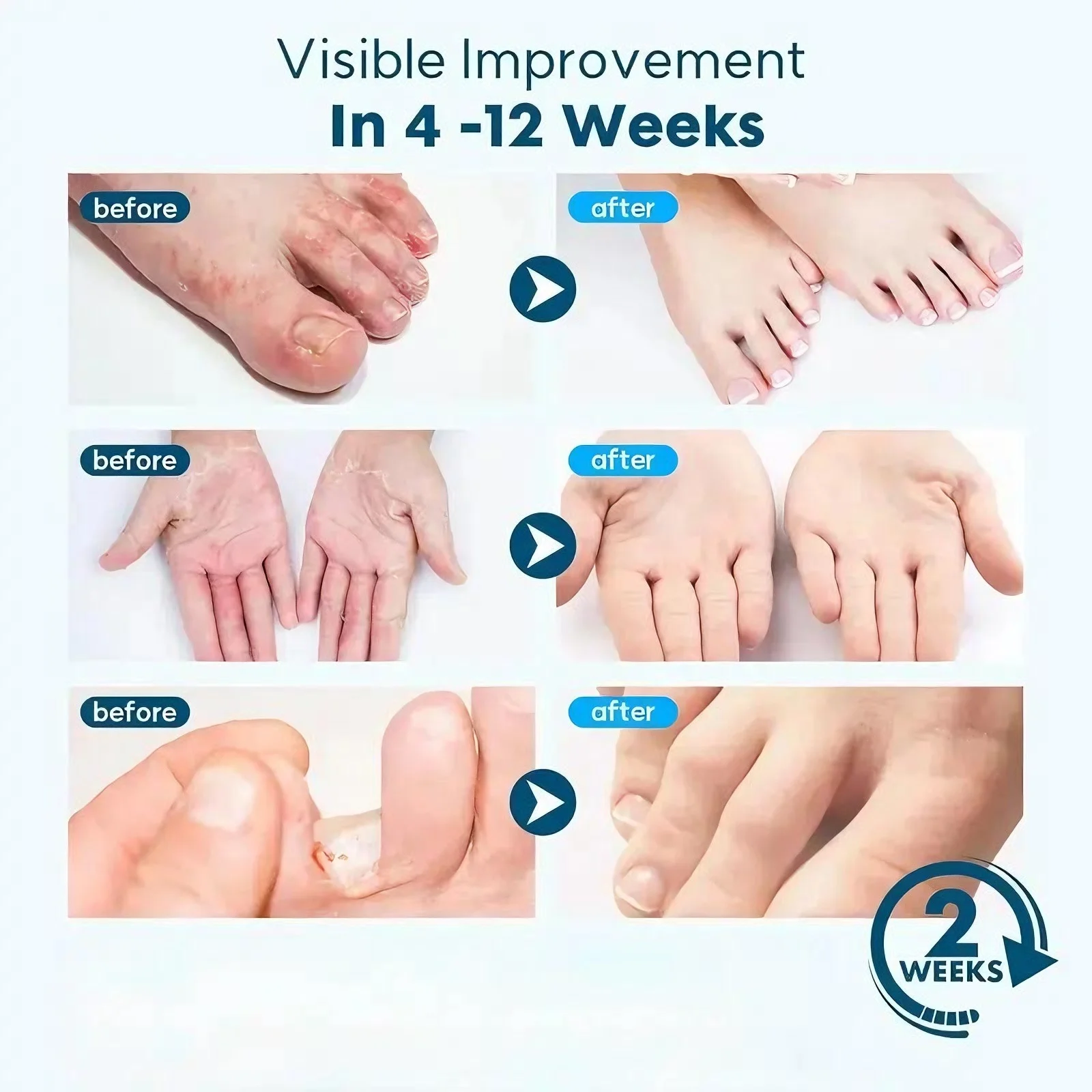 つま先ケア、深く保湿