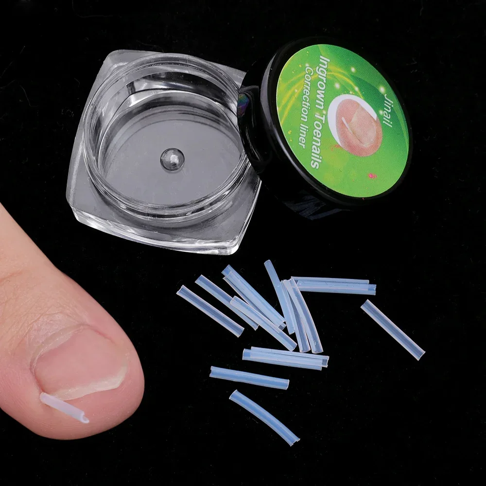 Ingrown Toenail Correção Tiras, Tubo elástico em forma de C Pad, Endireitando Clipes, Paroníquia Correção Toe Nail Tratamento Strip