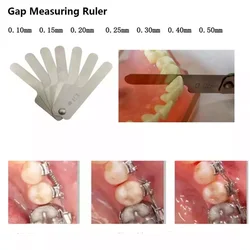 Oral Interproximal Reduction Gauge Ruler Tooth Gap Measure Reciprocating IPR System Stainless Steel Orthodontic Instrument