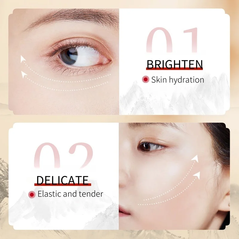 Astragalus Whitening Freckle Cream Remove Melasma Lighten Spots Brighten Skin Moisturizing Anti-Aging Dry Skin Care