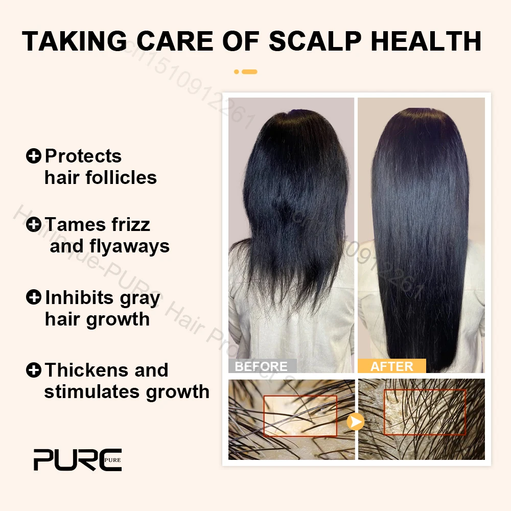 PURC Biotin Hair Growth Products for Men Women Hair Loss Scalp Treatment Serum Fast Grow Thicken Regrowth Oil Hair Care