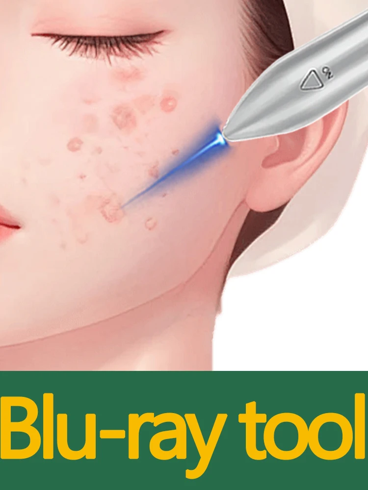 

2025 new models Tool Clips Light Tool Tweezers For Solve Warts