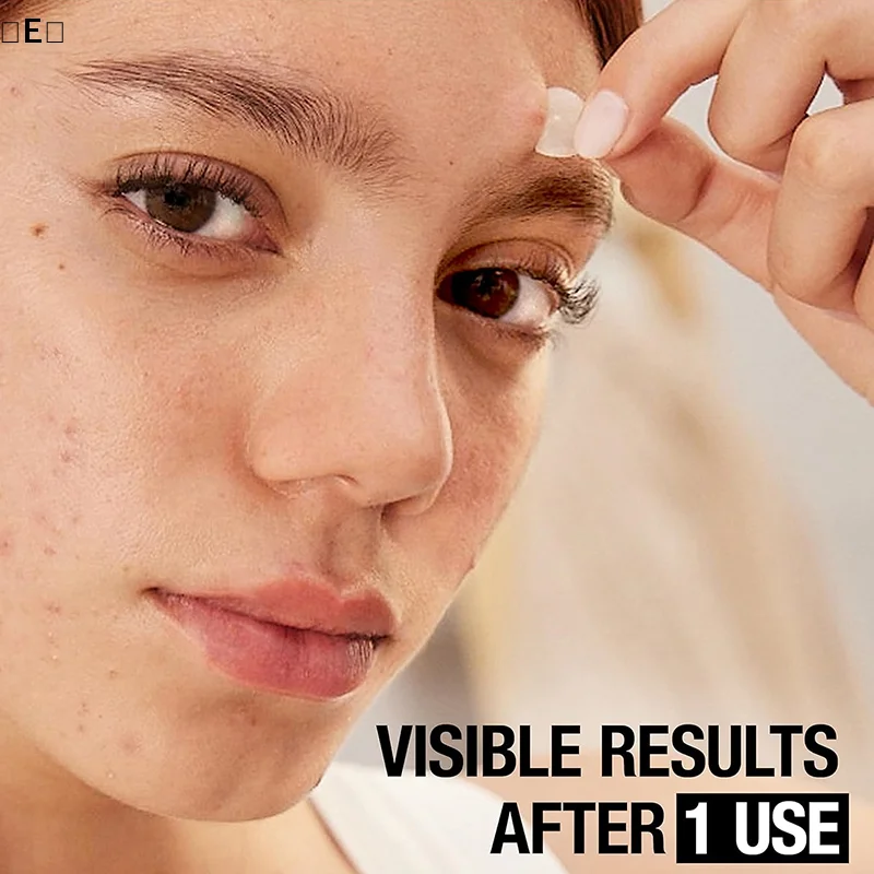 

360 шт. невидимых гидроколлоидных пластырей для удаления прыщей, маскировки следов акне, инструмент для макияжа, восстанавливающая наклейка